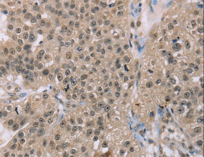 ACTN2 Antibody