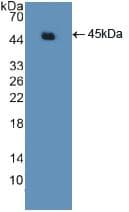 ACTG2 Antibody (aa3-376, PE)