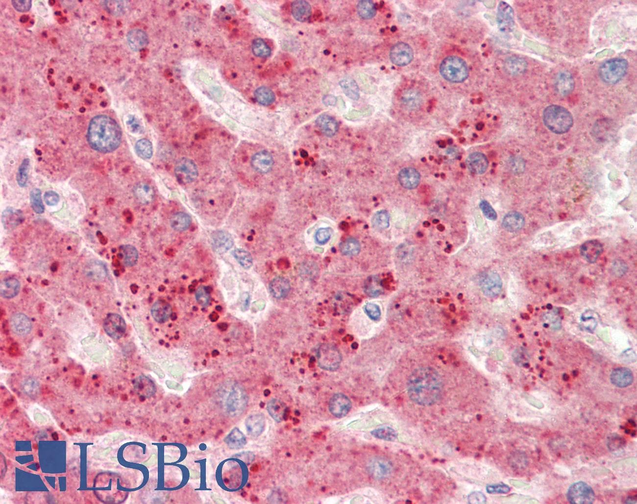 IHC-plus™ RPL23 / Ribosomal Protein L23 Antibody (aa123-135)