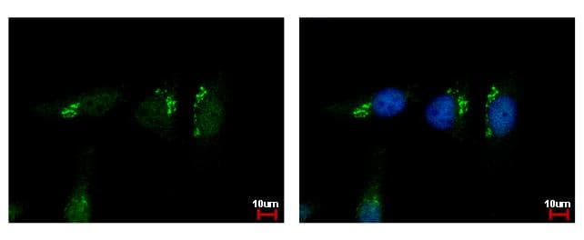 VBP1 Antibody (aa1-173)
