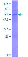 Human HDS / DHDDS Protein (Recombinant GST)