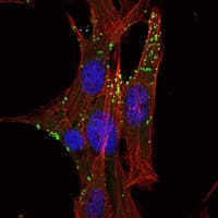 Monoclonal Mouse anti-Human KLHL1 Antibody (clone 3A8, IF, WB)