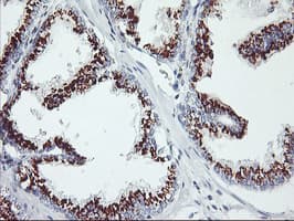 GOLM1 / GP73 / GOLPH2 Antibody (clone OTI3D7)