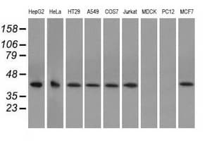 Monoclonal Mouse anti-Human ACAT2 Antibody (clone OTI1G6, IHC, IF, WB)