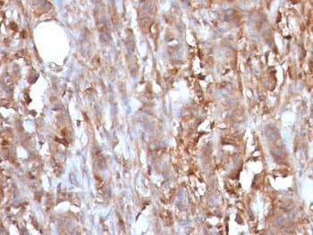B2M / Beta 2 Microglobulin Antibody (clone B2M/961, Ready-to-Use)