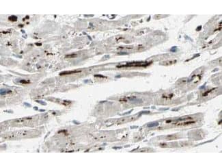 PPP1R13L / iASPP Antibody