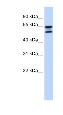 ACOT11 / THEA Antibody (aa504-553)