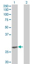 Monoclonal Mouse anti-Human EPO / Erythropoietin Antibody (clone 4G7, WB)