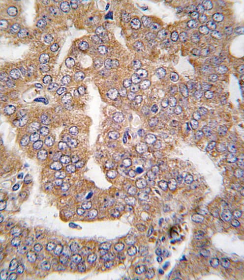 PAK4 Antibody (aa156-187)