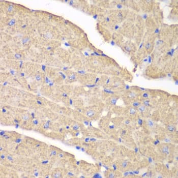 Polyclonal Rabbit anti-Human VDAC1 / PORIN Antibody (aa1-283, IHC, IF, WB)