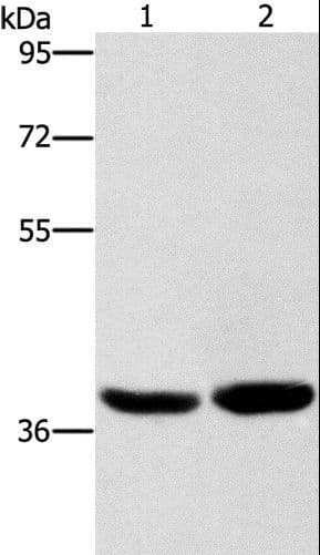 CAB39L Antibody