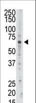 Polyclonal Rabbit anti-Human PAPSS2 Antibody (aa544-574, IHC, WB)