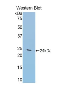 GLDC Antibody (aa81-268)