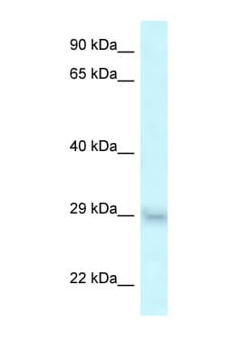 Polyclonal Rabbit anti-Human SRA1 / SRA Antibody (aa92-141, WB)