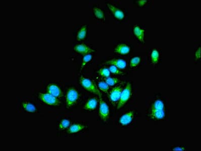 IHC-plus™ Polyclonal Rabbit anti-Human PHPT1 Antibody (IHC, WB)