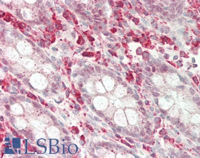 IHC-plus™ KLRC2 / NKG2C / CD159c Antibody (aa1-30)