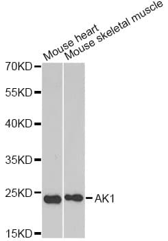 AK1 / Adenylate Kinase 1 Antibody