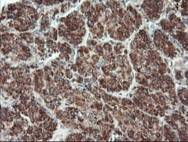 UBE2E3 Antibody (clone OTI6D3)