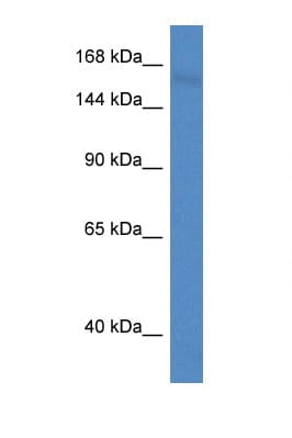 Polyclonal Rabbit anti-Mouse PCDH11X / Protocadherin 11 Antibody (aa446-495, WB)