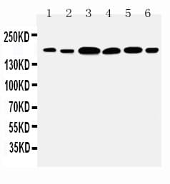 LAMC1 / Laminin Gamma 1 Antibody (aa1566-1579)