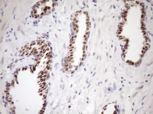 Monoclonal Mouse anti-Human WTAP Antibody (clone OTI12G6, aa2-106, IHC, WB)