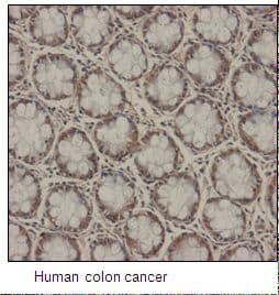 DDX6 Antibody