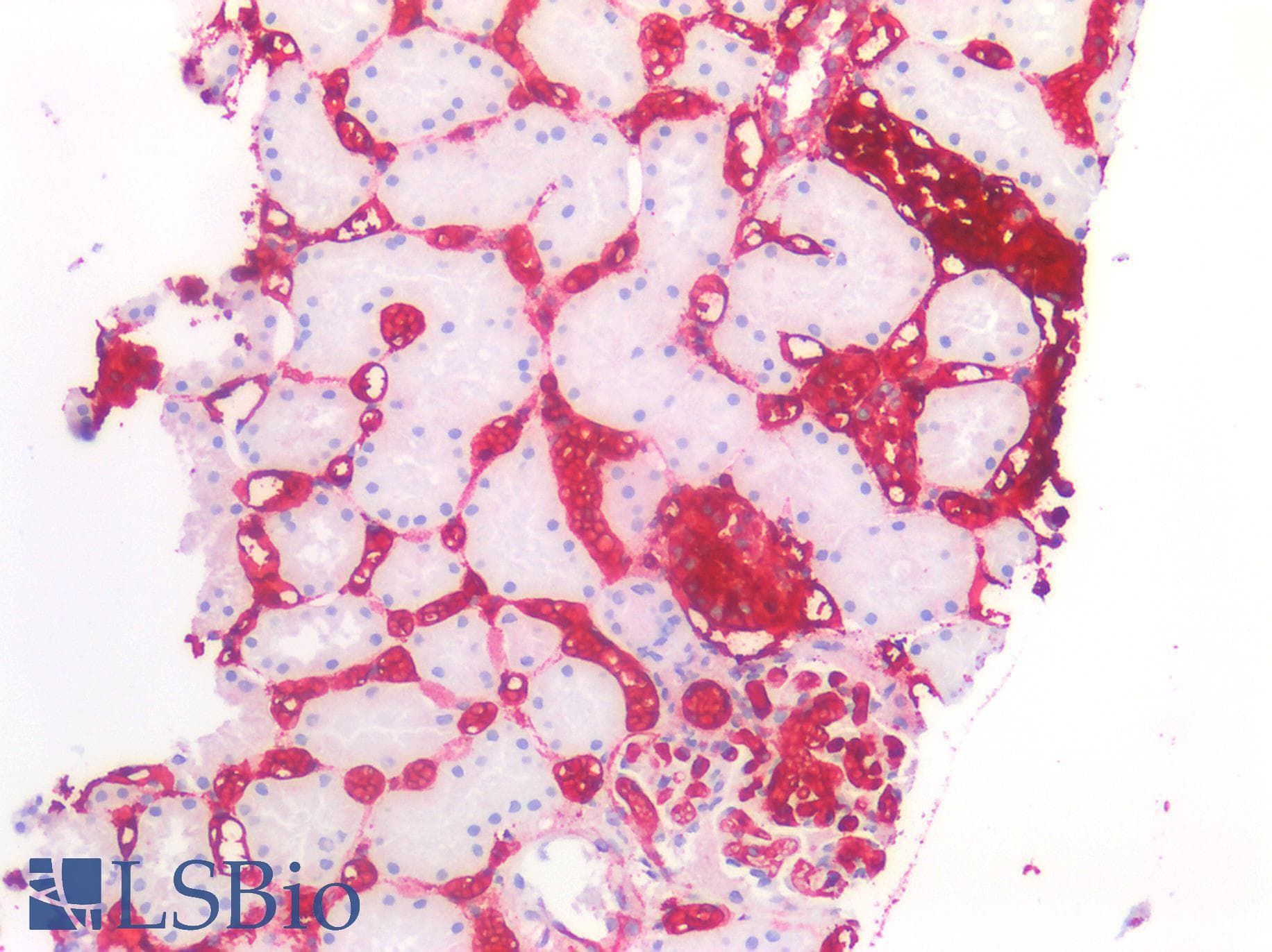 IHC-plus™ Blood Group A Antibody (clone B480)