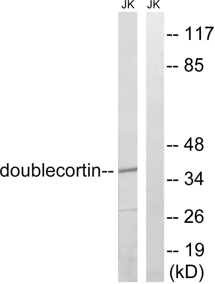 DCX / Doublecortin Antibody (p376)