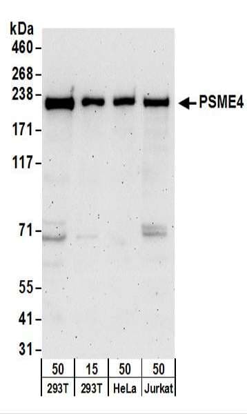 PSME4 / PA200 Antibody (aa1-50)