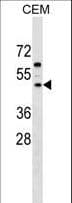 FBL8 / FBXL8 Antibody (aa57-83)