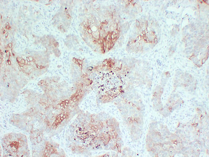 IHC-plus™ Cytokeratin 5+6 Antibody (clone ABT-CK5/6)