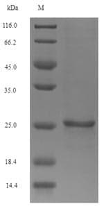 Black mamba Toxin MIT1 (Dendroaspis polylepis) Protein (Recombinant 6His-SUMO, N-terminus)