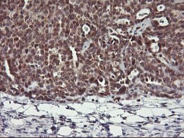 Monoclonal Mouse anti-Human USP10 Antibody (clone OTI1A10, IHC, WB)
