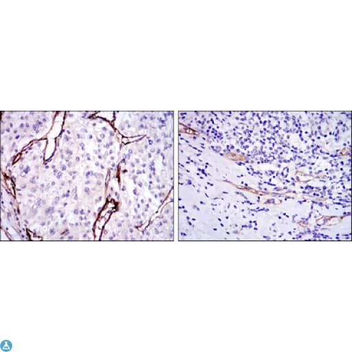 CD105 Antibody