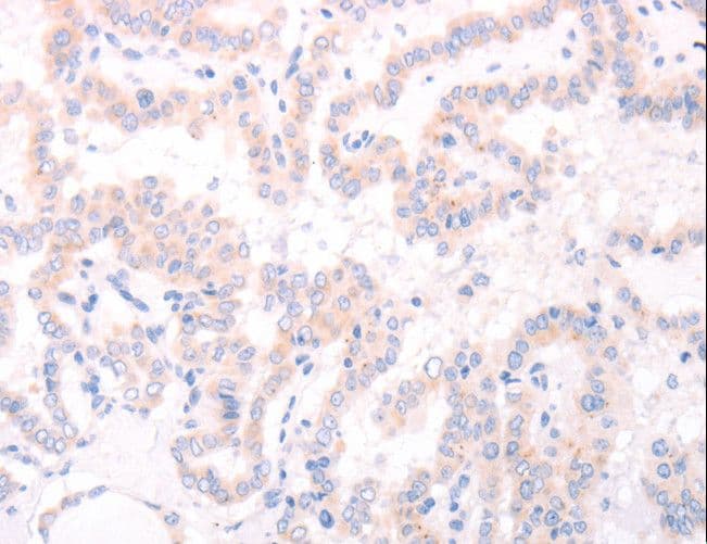 AMH / Anti-Mullerian Hormone Antibody