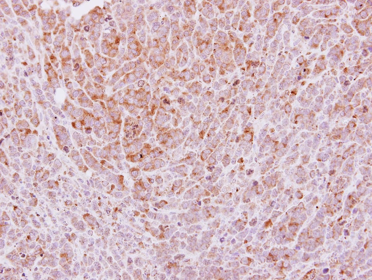LAMC2 / Laminin Gamma 2 Antibody (aa445-657)