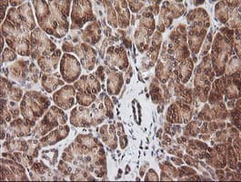 Monoclonal Mouse anti-Human RIOK2 Antibody (clone OTI3E11, IHC, IF, WB)