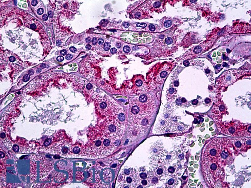 IHC-plus™ KIAA1524 / p90 Autoantigen Antibody (C-Terminus, clone 2G10)