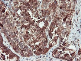 SERPINB1 Antibody (clone OTI3B4)