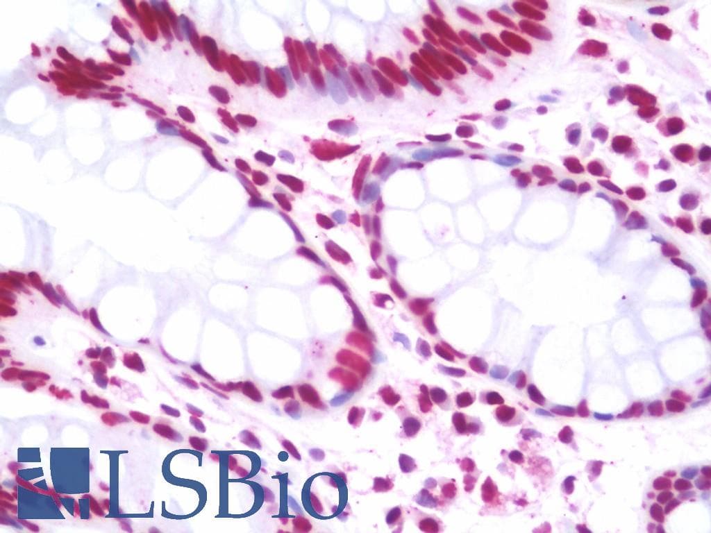 IHC-plus™ ERCC6 / CSB Antibody (aa346-766)