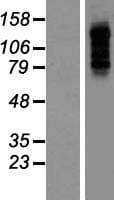 PBXIP1 / HPIP Protein (Over-Expression Lysate Myc-DDK (Flag))