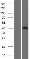 PPM1L Protein (Over-Expression Lysate Myc-DDK (Flag))