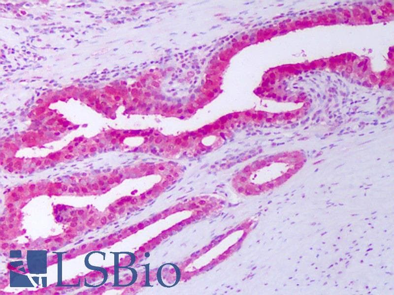 IHC-plus™ Polyclonal Rabbit anti-Human TIMP1 Antibody (aa24-207, IHC, WB)