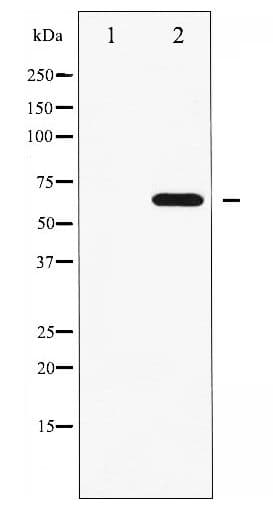 FRS2 Antibody (phospho-Tyr436)