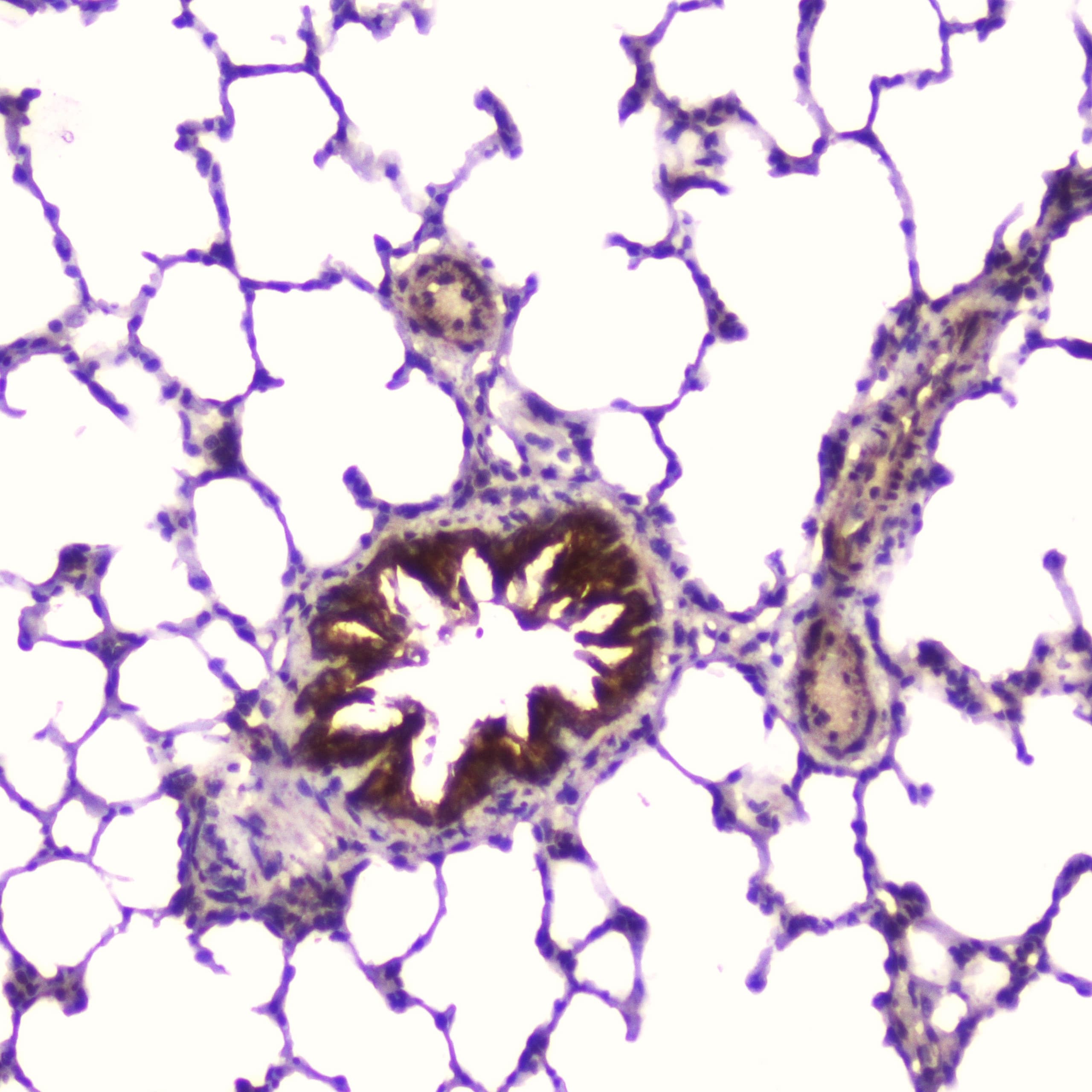 IGFBP2 / IGF-BP53 Antibody