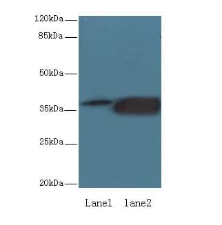 KLHDC8A Antibody