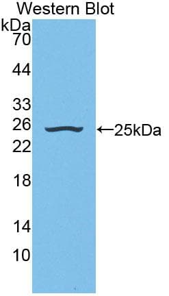 NEU2 / Sialidase 2 Antibody (aa185-379)