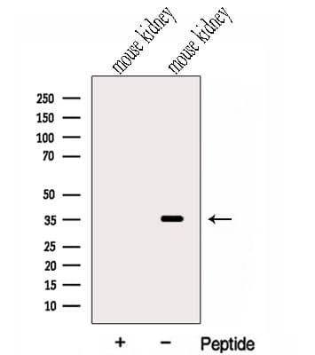Polyclonal Rabbit anti-Human HC71 / GLOD4 Antibody (WB)