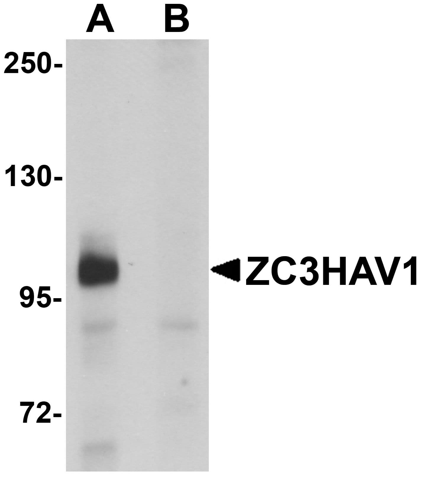 Polyclonal Rabbit anti-Human PARP13 / ZC3HAV1 Antibody (IF, WB)