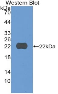 CYLD Antibody (aa170-338)